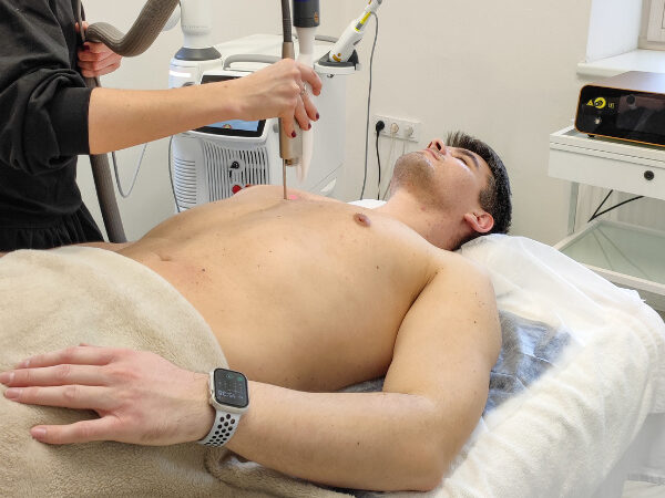 Laserová epilace přístrojem Fotona